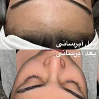 خدمات فیشال و پاکسازی پوست
