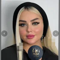 ژل و بوتاکس لیفت نخ زاویه سازی