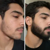 تا کی میخوای بدون ریش باشی