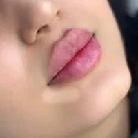 جشنواره ی عیدانه ژل لب گونه و خط خنده