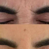 کرم بیوممتیک چین چروک