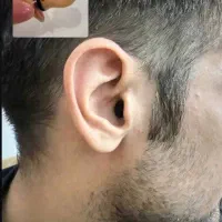 سمعک هوشمند نقد و اقساط با تست شنوایی رایگان