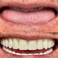 مرکزفوق تخصصی ایمپلنت دیجیتال/یکروزه/سبک کاخ لبخند
