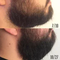معجزه ریشهات اینجاست