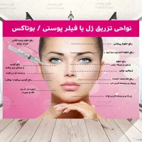 بوتاکس فقط ۱.۶۹۰.۰۰۰