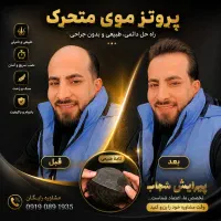 پروتز موی سینمایی vip