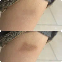 آموزش رفع تیرگی بدن