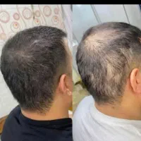 بهترین فرمول پرپشت شدن مو ابرو موژه