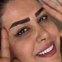 تخفیف یک ماهه میکروبلدینگ