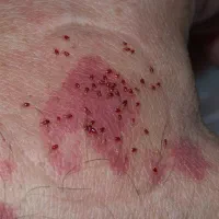 سمپاشی تخصصی ساس سوسک موریانه موش(خانگی وصنعتی)