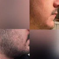 چسب پر پشتی ریش نیست بمب پرپشتی ریشه