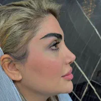 جراحی صورت و بینی اهواز