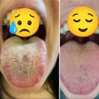 ازروی زبان مشکلات درونت رابفهم