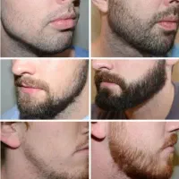 ۱۲ روزه ریشات درومده