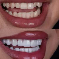 دندانپزشکی و دندانسازی(ویزیت رایگان)