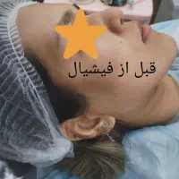 تخفیف ویژه مخصوص خانم ها برا فیشیال