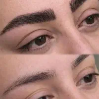 تخفیفات ویژه میکروبلیدینگ