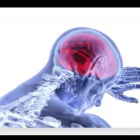 سردی مغز رفع مه مغزی تقویت حافظه