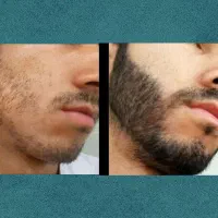 دیگه کوسه نباش