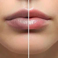 رفع تیرگی لب‌ به صورت رایگان
