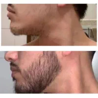 ته‌ریش کافی نیست