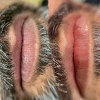 اصلاح رنگ لب آقایان