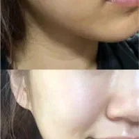 صابون روشنکننده و ضدلک قوی (تحویل فوری در اهواز)