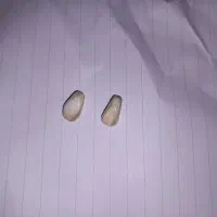 دو مهره سنگ قدیمی