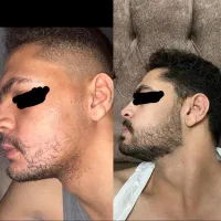 ریش پرپشت امضای جذابیت مردانست