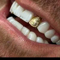 عصب کشی دندان با تعرفه دولتی