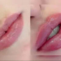جشنواره ویژه افتتاحیه مطب زیبایی لاغری
