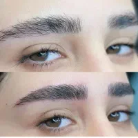 مدل میکروبلیدینگ