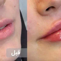 دوره اموزش خدمات زیبایی