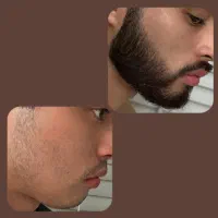 مردی که ریش نداره چیه
