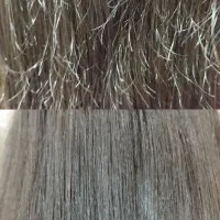 موخوره گیری روسی و روغن تراپی و اصلاح صورت