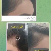 واقعا نگرانه مشکلات موت نیستی