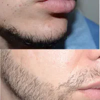 ارتقای جذابیت صورت