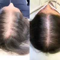 موهات داره کم‌پشت میشه