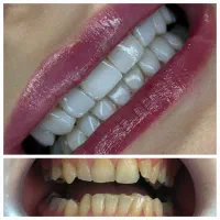 دندانپزشکی و دندانسازی دیجیتال اقساطی