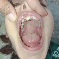 فروش سیم کارت رند 919 و 910 رند ر