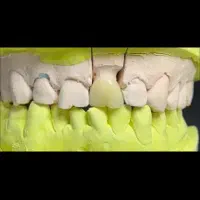 اموزش جامع دندان پزشکی و دندانسازی