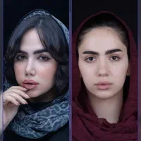 عمل بینی۳۹میلیون /قیمت سال قبل+اقساط