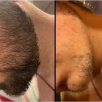 لامصب از کوسه بودن خسته نشدی