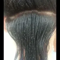 پاکسازی شپش و رشک دریک جلسه کاملاتضمینی