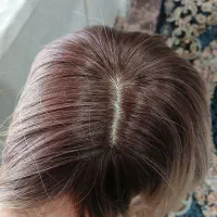 انواع کلاه گیس /پوستیژ/وارداتی نو