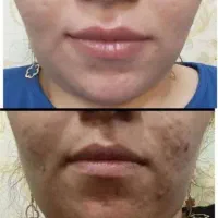 کرم اماراتی صورت وبدن