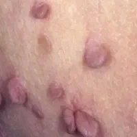خال