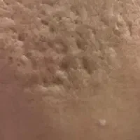 دیگه بابت مشکلات پوستی ناراحت نباش چون