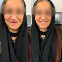 سلامت وزیبایی دندان