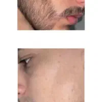 جذابیت تو20روز